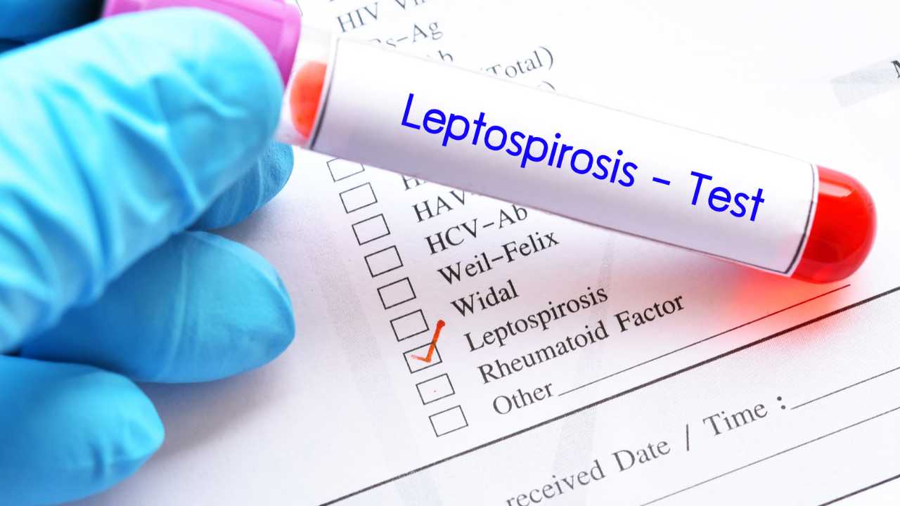 Leptospirosis