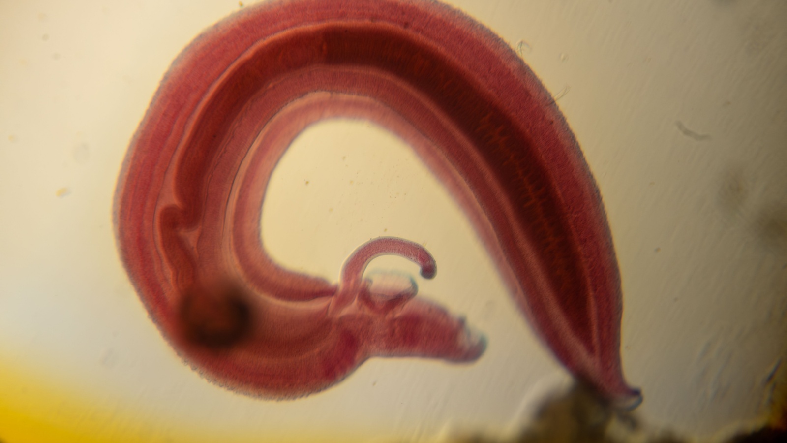 photo of human parasite worms under the microscope