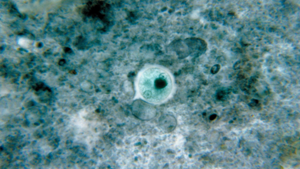 Entamoeba Histolytica
