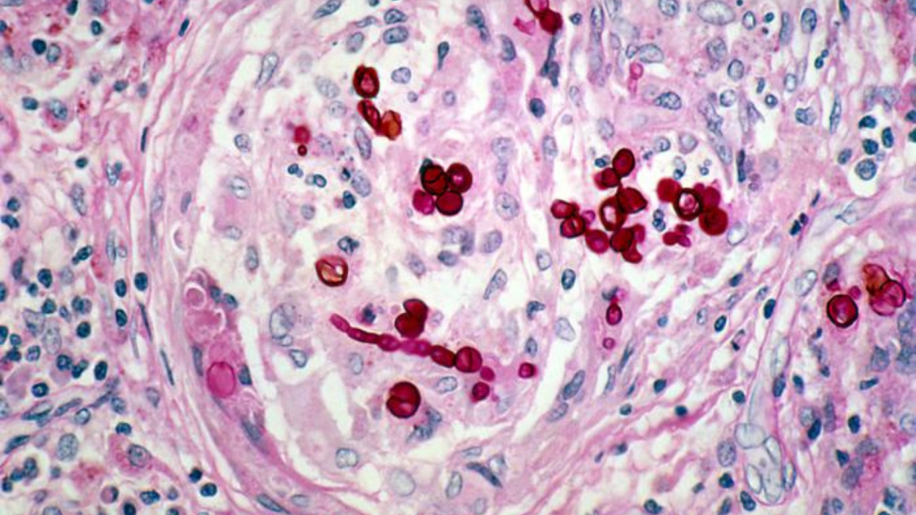 Radiotrophic Fungi