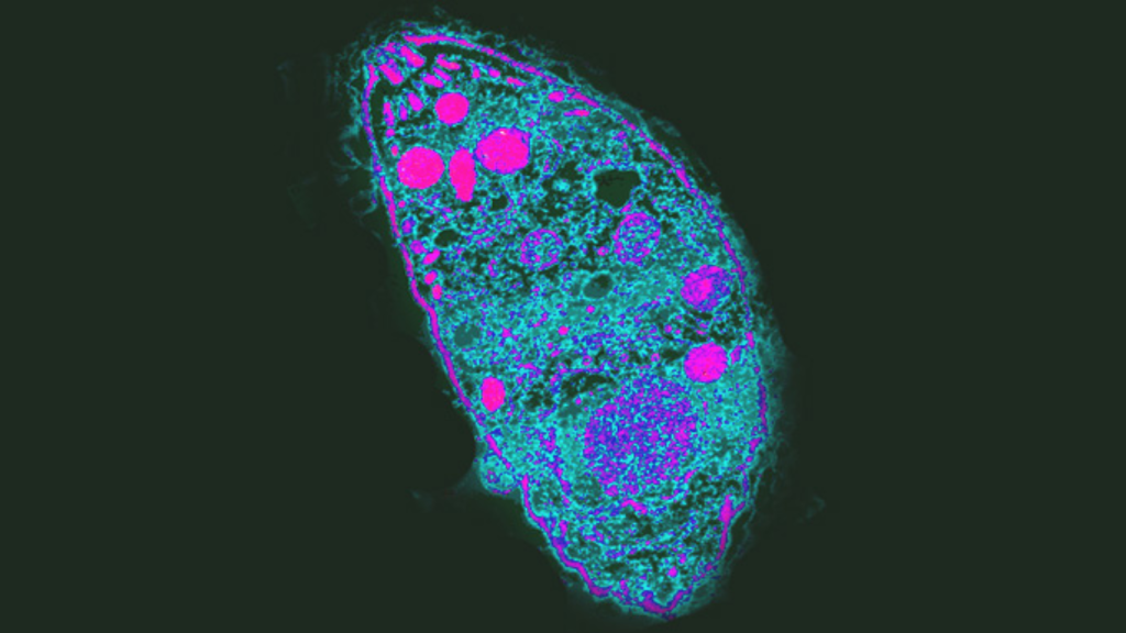 Toxoplasma Gondii