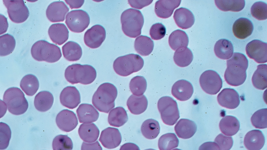 Plasmodium Falciparum